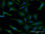 LIS1 Antibody in Immunocytochemistry (ICC/IF)