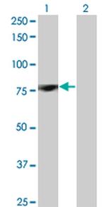 PKC delta Antibody in Western Blot (WB)