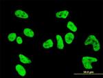 PKN1 Antibody in Immunocytochemistry (ICC/IF)