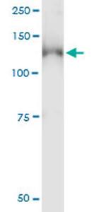 PKN1 Antibody in Immunoprecipitation (IP)