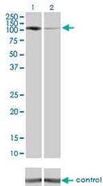 PKN1 Antibody in Western Blot (WB)