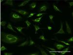 Ribophorin I Antibody in Immunocytochemistry (ICC/IF)