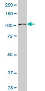 SP3 Antibody in Western Blot (WB)