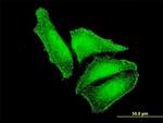 MST2 Antibody in Immunocytochemistry (ICC/IF)