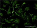 TAP1 Antibody in Immunocytochemistry (ICC/IF)