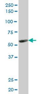 KLF10 Antibody in Western Blot (WB)