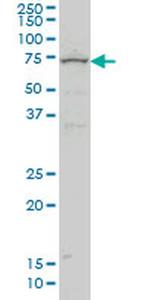 ZNF182 Antibody in Western Blot (WB)