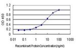 ZNF202 Antibody in ELISA (ELISA)