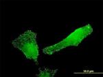 SH2D3C Antibody in Immunocytochemistry (ICC/IF)