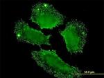 SH2D3C Antibody in Immunocytochemistry (ICC/IF)