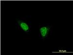 TSHZ1 Antibody in Immunocytochemistry (ICC/IF)