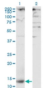 CD299 (DC-SIGN/L) Antibody in Western Blot (WB)