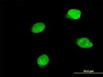 BRD8 Antibody in Immunocytochemistry (ICC/IF)