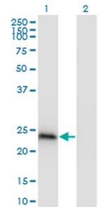 HP1 beta Antibody in Western Blot (WB)