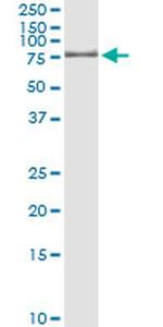 GTF2A1L Antibody in Immunoprecipitation (IP)