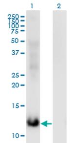 MSRB2 Antibody in Western Blot (WB)