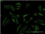 ABCB9 Antibody in Immunocytochemistry (ICC/IF)