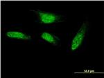 SEC14L2 Antibody in Immunocytochemistry (ICC/IF)