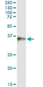 SNX11 Antibody in Immunoprecipitation (IP)