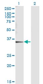 SNX11 Antibody in Western Blot (WB)