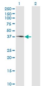 PIPOX Antibody in Western Blot (WB)