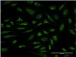 PIH1D1 Antibody in Immunocytochemistry (ICC/IF)