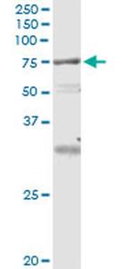 VPS18 Antibody in Immunoprecipitation (IP)