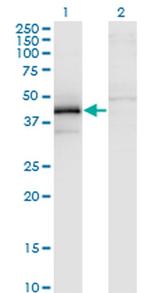 ZFYVE19 Antibody in Western Blot (WB)