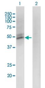 ACMSD Antibody in Western Blot (WB)