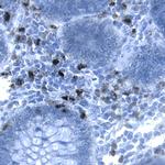 CEACAM1 Antibody in Immunohistochemistry (Paraffin) (IHC (P))