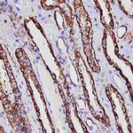 FABP1 Antibody in Immunohistochemistry (Paraffin) (IHC (P))