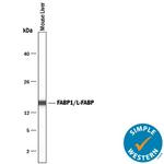 FABP1 Antibody in Western Blot (WB)