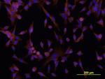 DSCAM Antibody in Immunocytochemistry (ICC/IF)