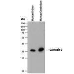 Calbindin D28K Antibody in Western Blot (WB)