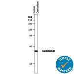 Calbindin D28K Antibody in Western Blot (WB)