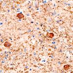 PLXNB1 Antibody in Immunohistochemistry (Paraffin) (IHC (P))