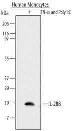 IL-28B Antibody in Western Blot (WB)