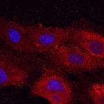 Plexin A2 Antibody in Immunocytochemistry (ICC/IF)