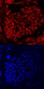 PRDM14 Antibody in Immunocytochemistry (ICC/IF)