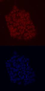 KLF2 Antibody in Immunocytochemistry (ICC/IF)