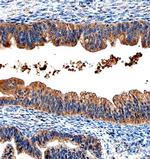 WFDC2 Antibody in Immunohistochemistry (Paraffin) (IHC (P))