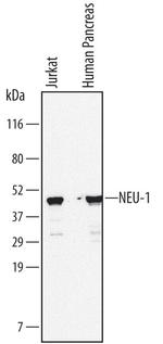 NEU1 Antibody in Western Blot (WB)