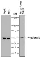 Arylsulfatase B Antibody in Western Blot (WB)