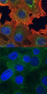 Phospho-Axl (Tyr779) Antibody in Immunocytochemistry (ICC/IF)