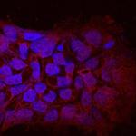 AMER1 Antibody in Immunocytochemistry (ICC/IF)