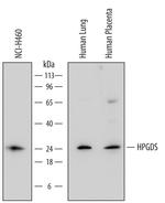 HPGDS Antibody in Western Blot (WB)