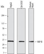 VAPB Antibody in Western Blot (WB)