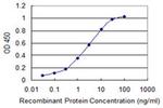 Calmodulin 3 Antibody in ELISA (ELISA)