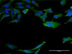 Calmodulin 3 Antibody in Immunocytochemistry (ICC/IF)