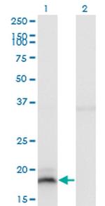 IFNA13 Antibody in Western Blot (WB)